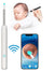 Earwax Removal Kit – Smart Visual Earwax Removal Tool